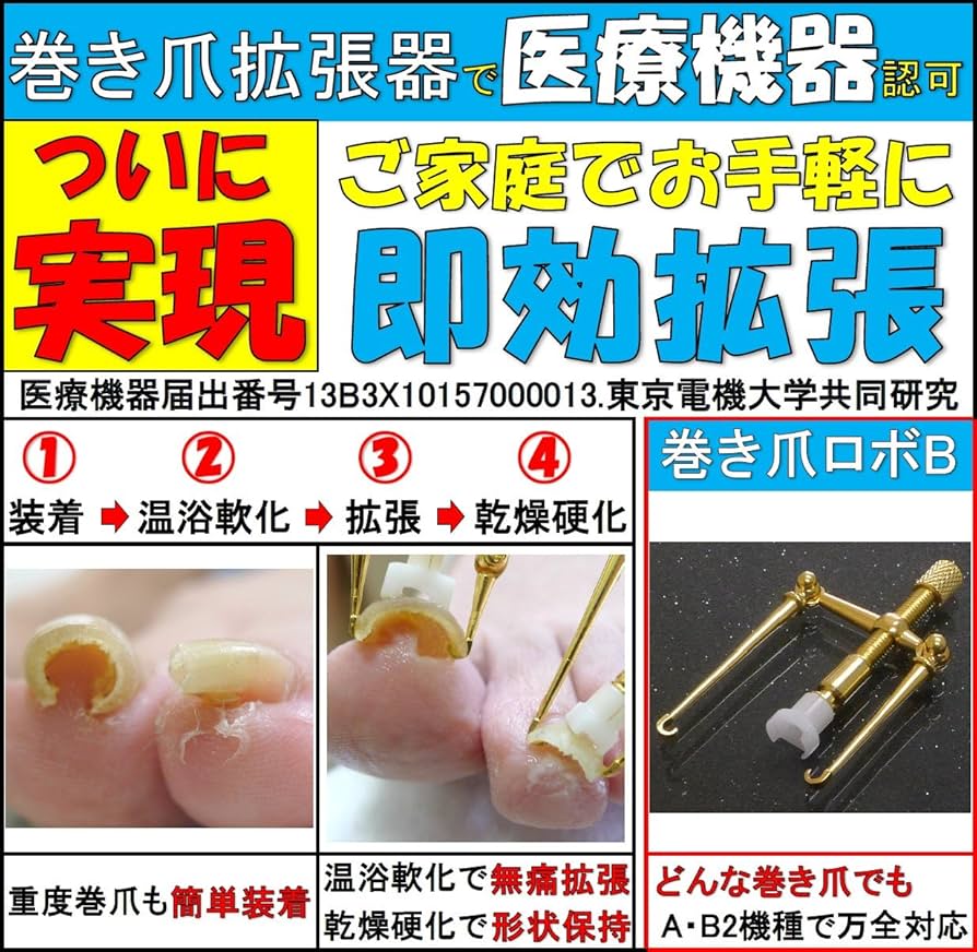 巻き爪ロボ Amazon | 巻き爪ロボ (Aタイプ) | 巻き爪ブロック | 巻き爪ケア